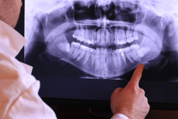 Best Emergency Dental Services for Seniors in Kinston, NC