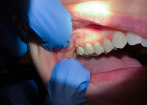 Best Holiday Emergency Dentist in Kinston, NC