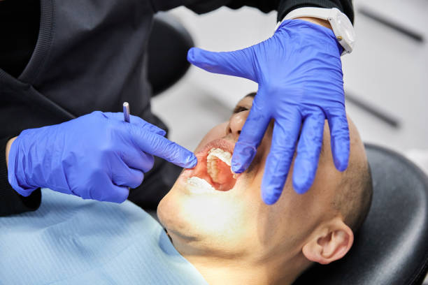 Best Emergency Dental Extractions in Kinston, NC