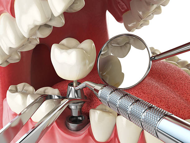 Best Holiday Emergency Dentist in Kinston, NC